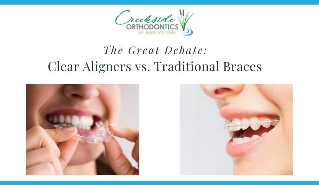 The Great Debate: Clear Aligners vs. Traditional Braces