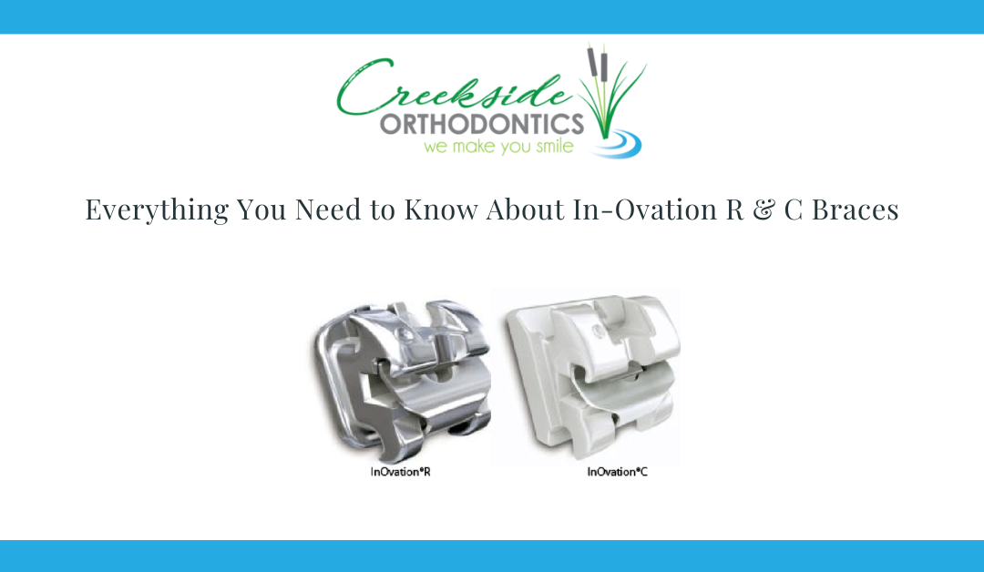 Everything You Need to Know About In-Ovation R & C Braces